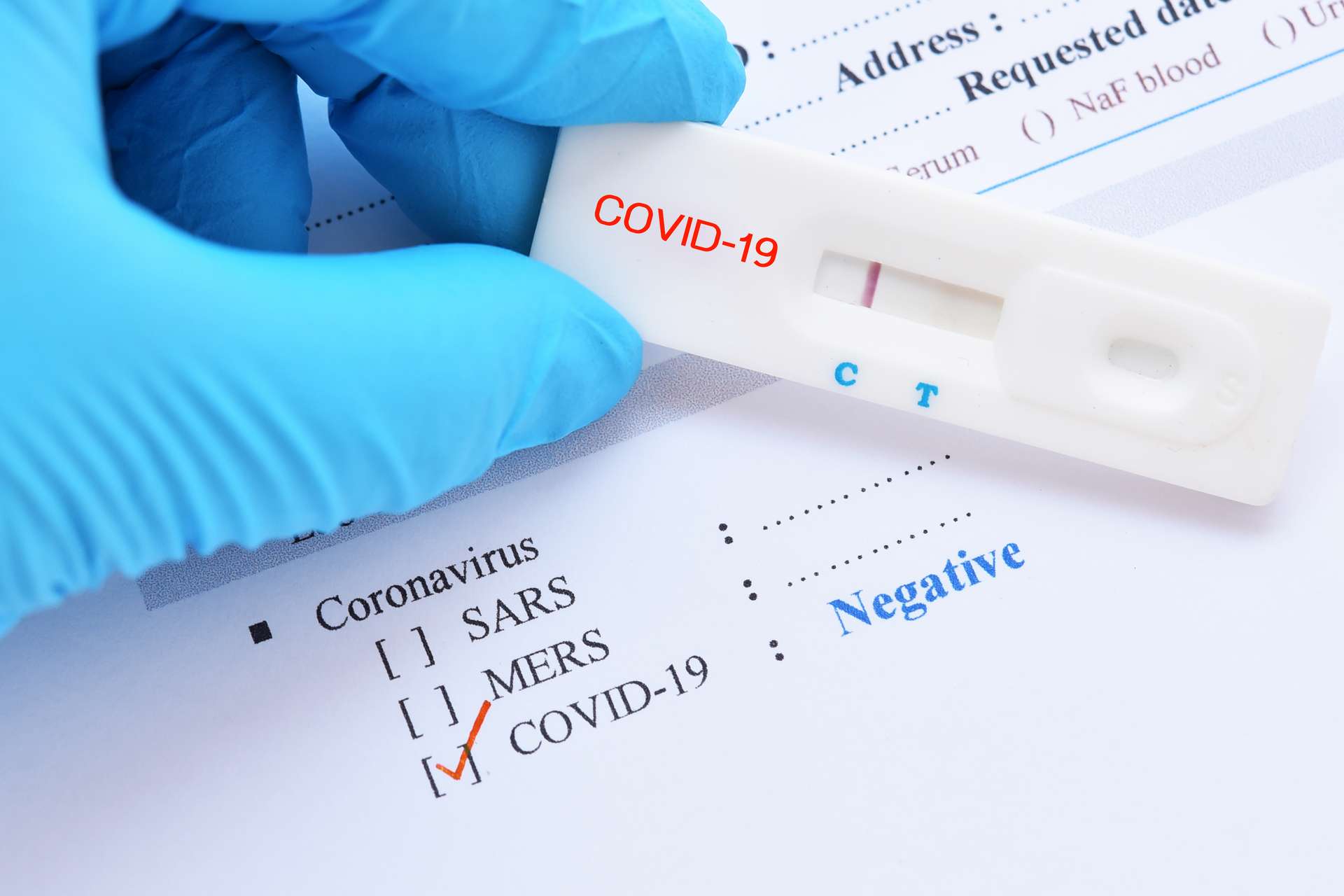 COVID-19 : les résultats d’une étude soulignent un risque d’infection grave par le SARS-CoV-2 chez les personnes infectées par le VIH qui présentent des comorbidités liées à l’âge Wang H & al.  Clinical Summary  3 déc. 2021     À retenir  Les per