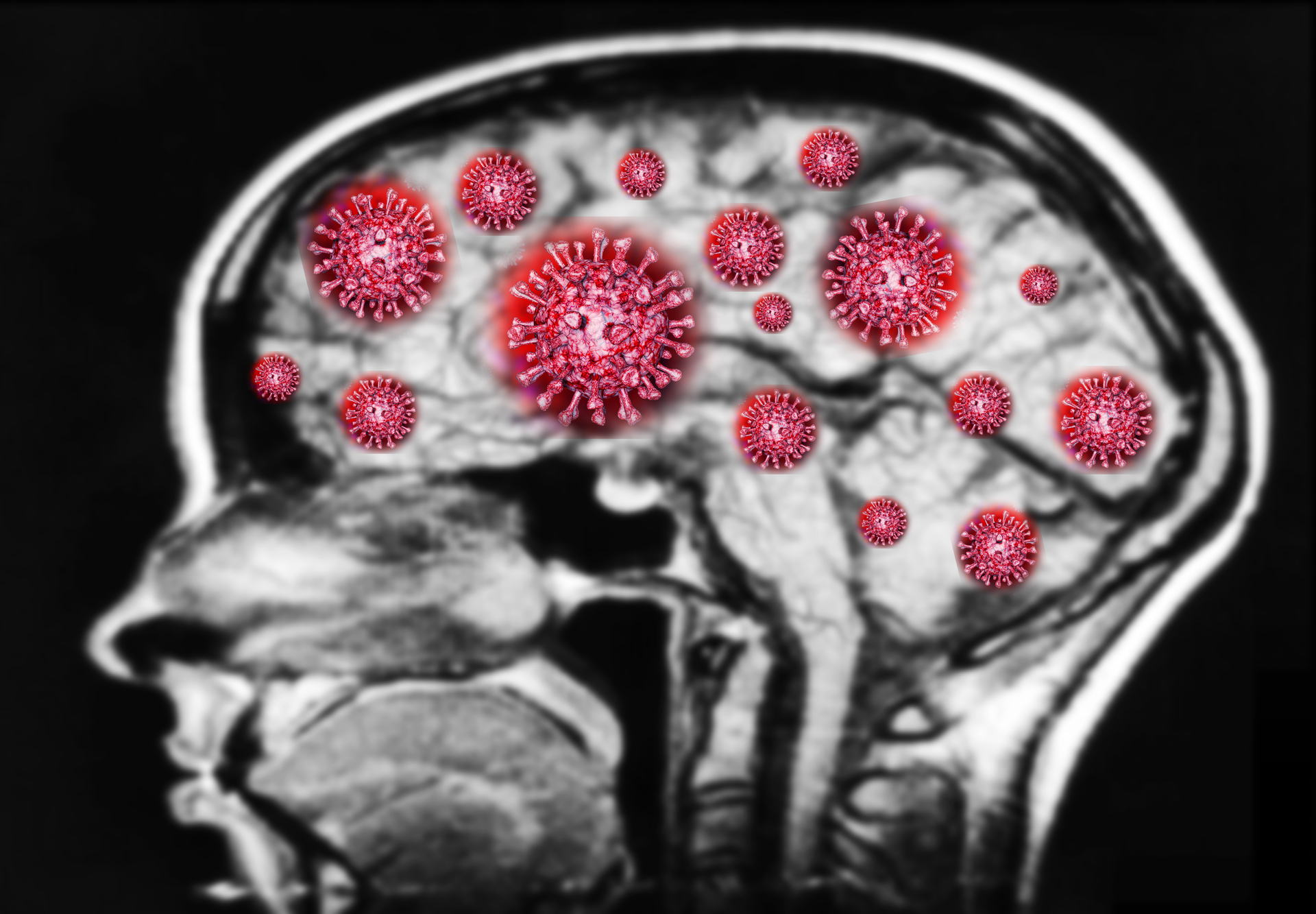 COVID-19 : le cerveau des enfants en danger